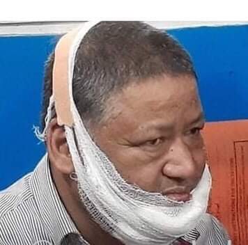 रुपन्देहीमा फेरि कुटिए देउवा पक्षबाट पौडेल समूहका कार्यकर्ता