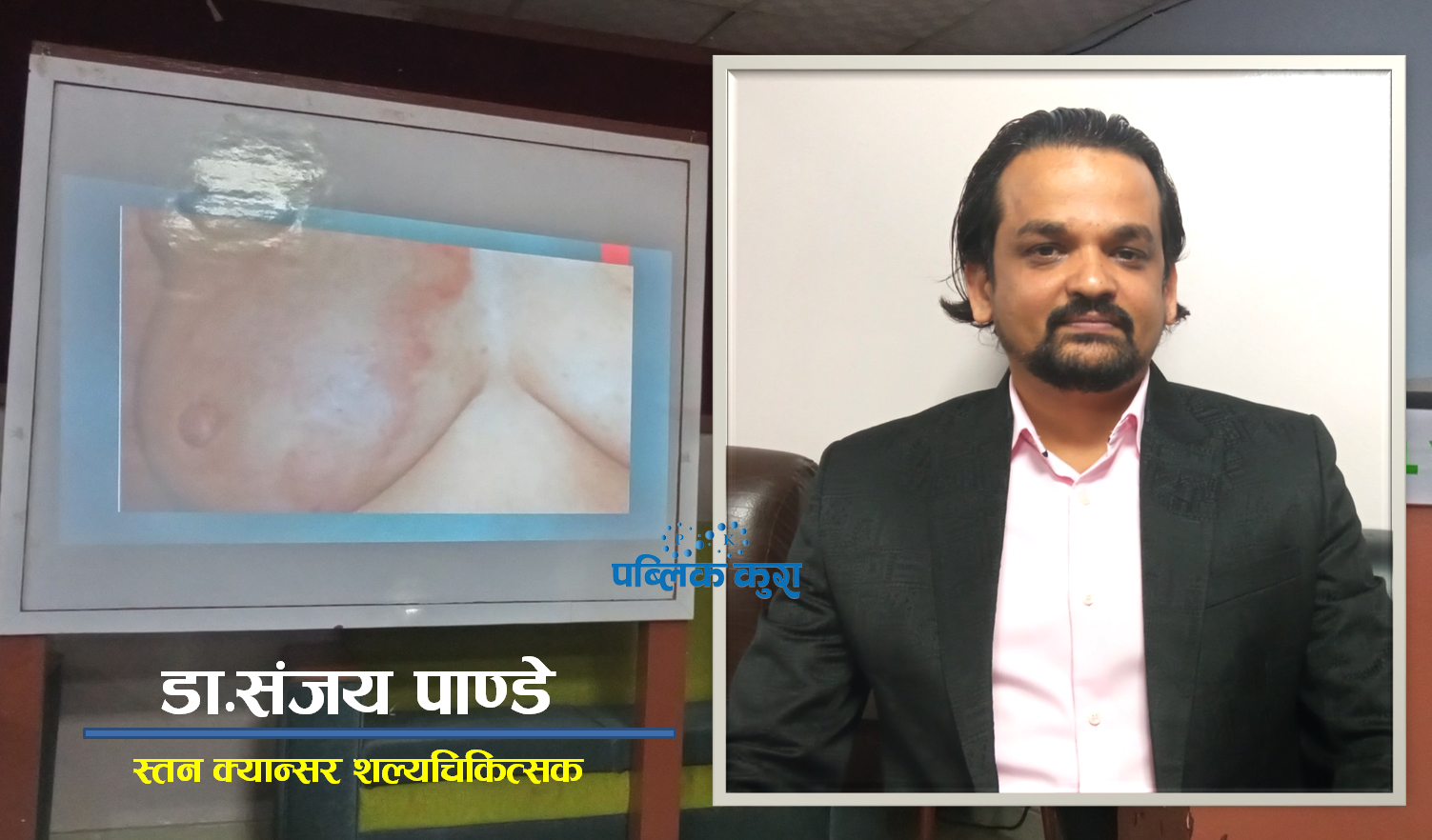डा.संजय पाण्डेः जसले भैरहवामै स्तन क्यान्सरको सफल शल्यक्रिया गरे