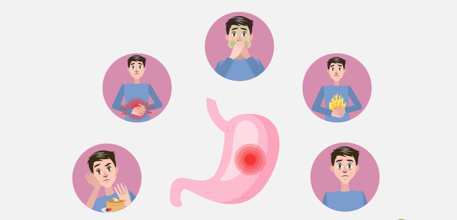 ग्यास्ट्रिक क्यान्सर के हो, कस्ता हुन्छन् लक्षण ?
