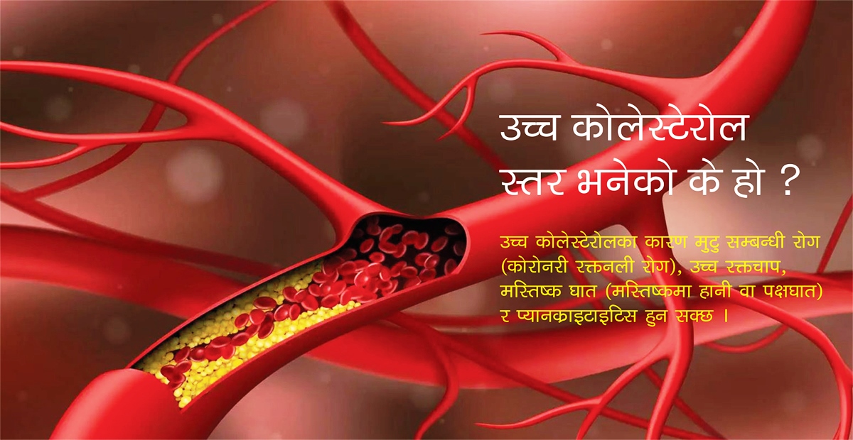 उच्च कोलेस्टेरोलको रोकथाम र व्यवस्थापन