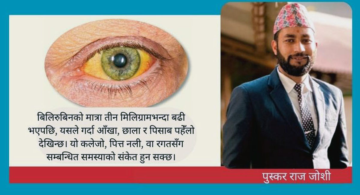 जन्डिस भनेको के हो ? जन्डिस हुँदा के खाने, के नखाने ?